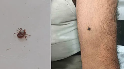 Kabus devam ediyor: Kayseri’nin bir ilçesinde daha kene vakası görüldü